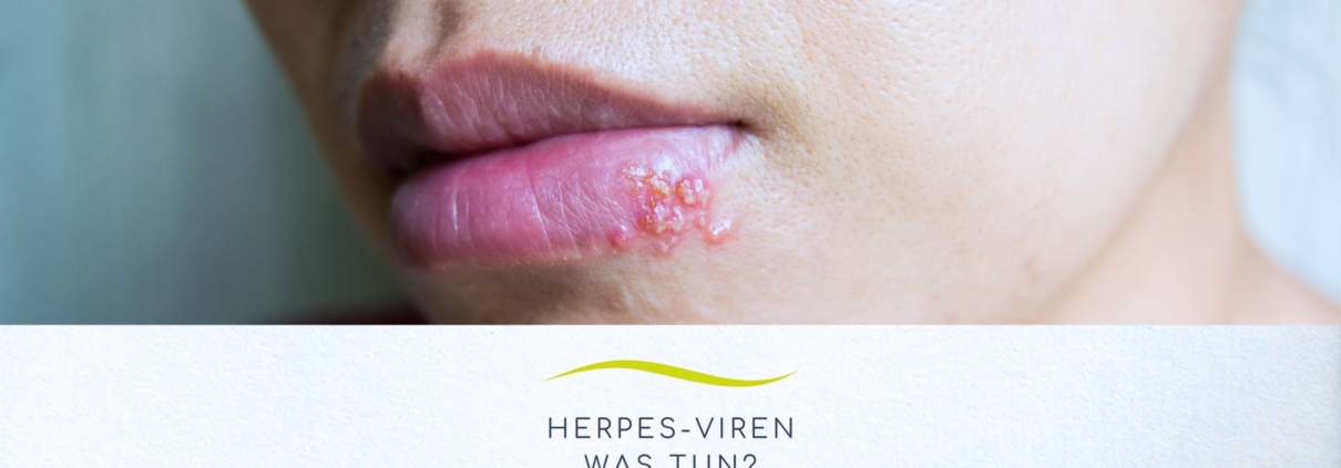 Frau mit Lippen und Herpes-Viren