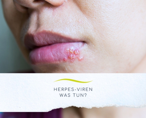 Frau mit Lippen und Herpes-Viren