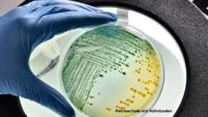 Petrieschale in Hand mit blauen Handschuhen gehalten